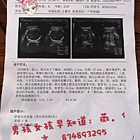 我家宝贝32周了 开心