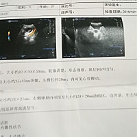 他们那个B超怎么做出来的？