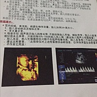 宝宝四维一点都不配合，害我跑楼梯跑了一个多小时，检查了三次才勉强拍到了侧面，第一胎啥也不懂，求懂...