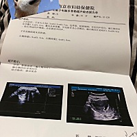 第一次去做b超是闭经45天，只查出来液性暗区，连孕囊都没有。担惊受怕了一星期后今天去复查！有胎心胎芽...