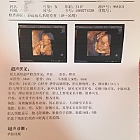 本人2次四维结果，麻烦有经验的帮忙看看性别吧？请注明原因，谢谢啦🙏