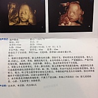 好奇是男宝还是女宝，有看的懂的吗？