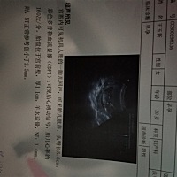 大家帮我看看男女，三个月做的NT