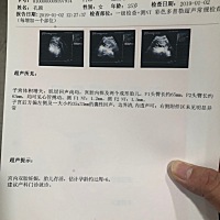 老婆给我的惊喜，第一次当准爸爸，是两个娃，嘿嘿