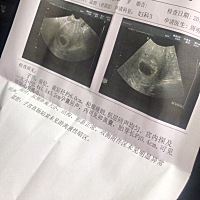 我今年25岁了，已经两个女儿了，现在就想要个儿子，已经有快十周了！可以看B超验男女？心急哦！有会看B...