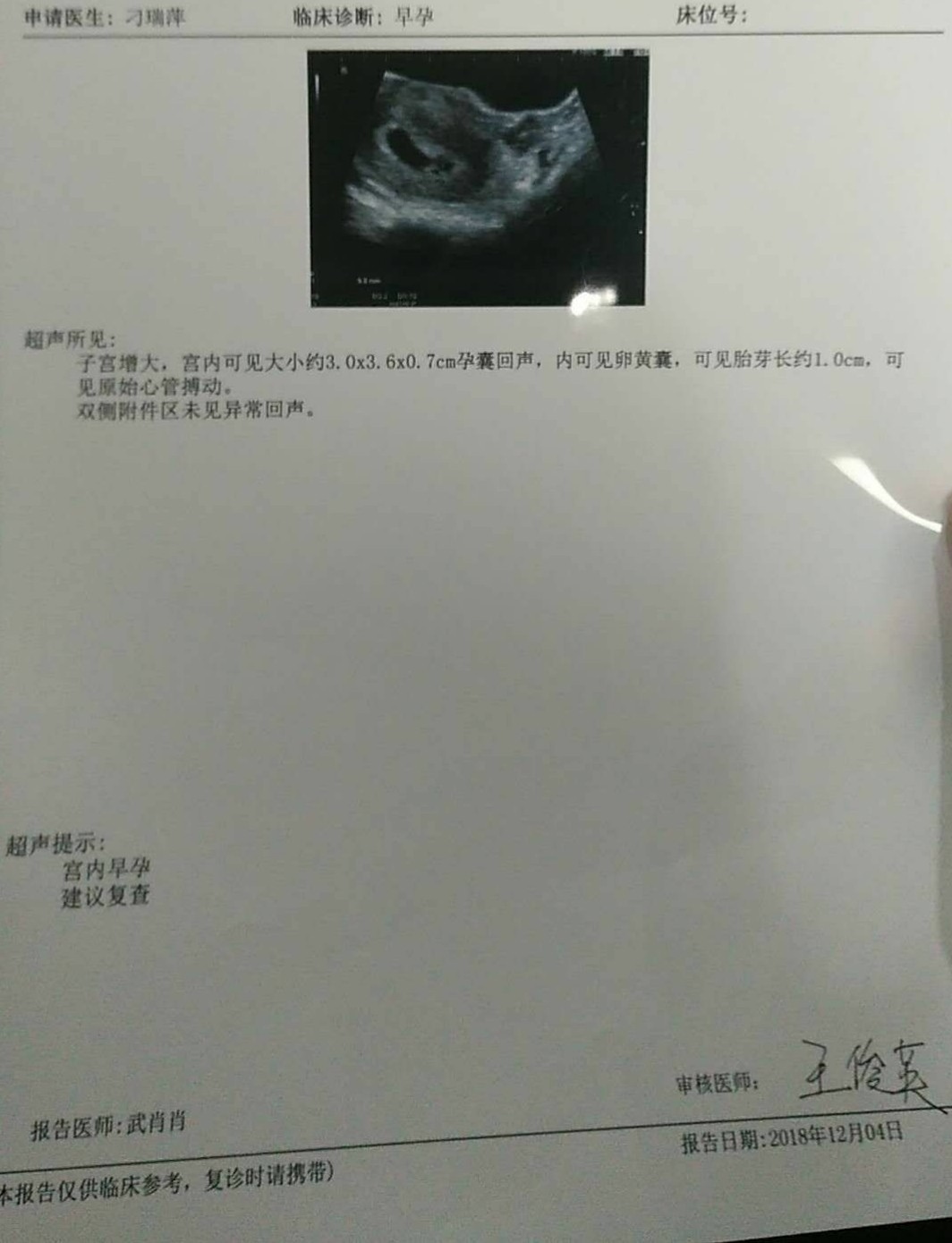 怀孕47天做的b超能看出来男孩女孩吗