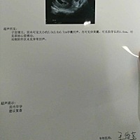 怀孕47天做的b超能看出来男孩女孩吗
