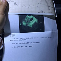 怀孕都八周多了，怎么会是空孕囊了，而且不发育，好心痛，医生说建议不要，立刻做手术，好不容易怀孕了...