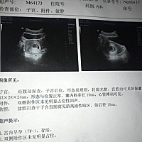 麻烦大家帮我看下孕囊像男像女 谢谢