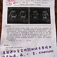 尖肚子是男宝，准了。预期反应不大是男宝，也准了。肚子变黑长毛也准了，皮肤变差不准，胎心不准，一直1...