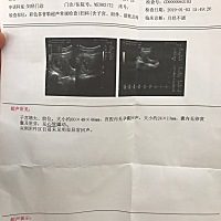 第二胎了。第一胎是男孩。这次怀孕了我们一家三口都想要个女孩。想要儿女双全。但是自己看不懂。今天在...