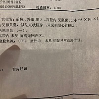 孕七周+1，做阴超似见点状胚芽，未见胎心，唉，下周复查希望可以给我一个好结果，宝贝一定要坚强啊！