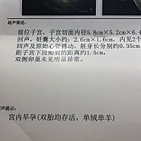 意外惊喜，接好孕