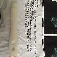 末次11.26，这是什么情况😭医生说没怀孕，是不是太早了？还是....前期天天测白板