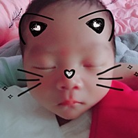 下巴长了一个痘痘 眼睛也有眼屎了 有没有什么办法