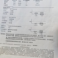 亲们谁会看这个东西，能看出来是男孩女孩吗？求解。