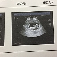 B超检查一切正常，早塞结果还要等几天，求通过🙏