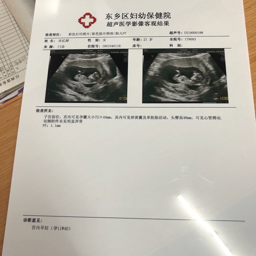 好开心 可以看出来男孩女孩吗 就是特别好奇 男孩女孩都喜欢～