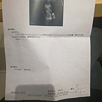 宝贝挺好的，终于放心了一点，现在真是一颗玻璃心，只希望宝贝好好在麻麻肚子里成长，期待着和宝贝的见面…