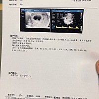 吃什么都没有胃口，天天喝稀饭，有时候觉得菜咸、有时候觉得淡。感觉好累啊。今天第一次去医院检查