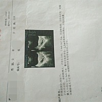 第一胎，不知道男女，有没亲们帮我看看，只是想提前几天知道，这几天搞的好紧张，