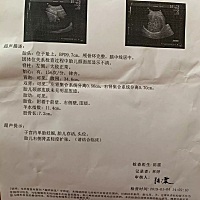 预产期过了4天了 医生让再过三天住院 下午做了B超 双顶径9.7 腹围34.6 股骨长7.2  我是头胎 我没信心顺...