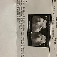 有怀双胞胎的宝妈们给点经验么？