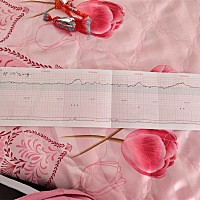 有没有宝妈知道37周加2了做小孩胎心检测医生说快建议刨腹产，目前在吸氧每天一小时吸三天看看吸完就挺稳...