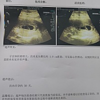 孕妈们帮我看看这形状是男宝还是女宝?大宝女儿，这胎想要个男宝凑成好字