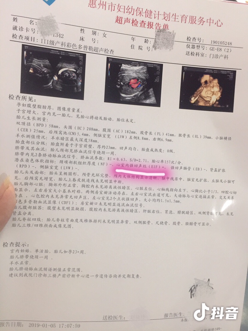 今天第一次四维，检查医生却说胎宝宝心脏上有两个亮点，怀疑是染色体有异常或者宝宝有先天性心脏病，但是染色体我做了无创，是没有问题的，而我们两家都没有先天性心脏病的遗传史，我不知道是哪里出了问题，本来就做的试管，这个宝宝来之不易。预约了后天的产前诊断专家去看，希望菩萨保佑一切顺利，真的伤不起啊！有没有大神懂这个的