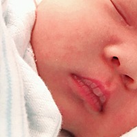 宝妈们，宝宝嘴唇👄上白白的是因为什么你们的宝宝有吗？