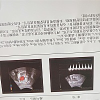 二胎 27周 4了 也是忐忑不安 查的唐氏筛查有高风险去做无创 医生不给做 说做了也查别出来  做的B 超是没...