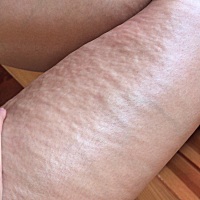 快30周了 这是要肿吗 腿一捏一使劲肉就变成这样 又知道的吗