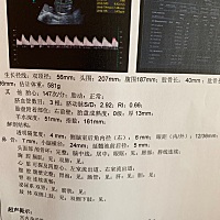 亲爱的孕妈们 谁懂，能看出是佩奇还是乔治吗？