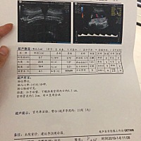 四维排畸B超单、有经验的看看男女哈哈就是好奇