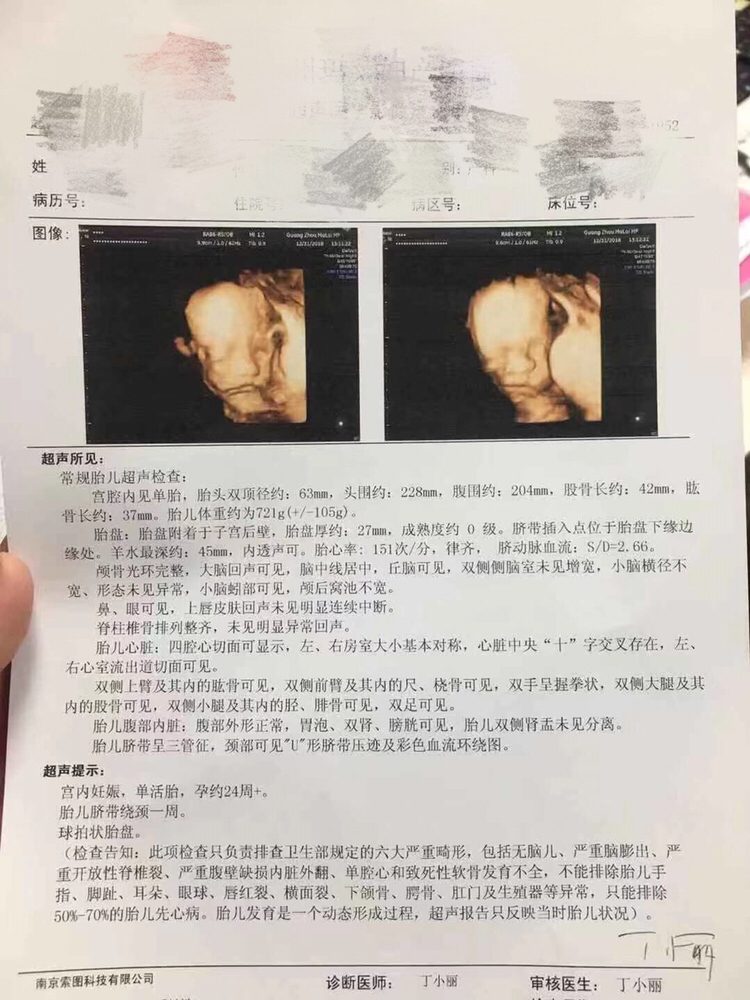 和老公结婚4年半终于怀上了宝宝，昨天四维通过！结婚第三年查出来卵巢早衰，中药西药各种方法都试过，肚子上胳膊上屁股上挨过几百针，不管怎样终于苦尽甘来，感恩上苍！