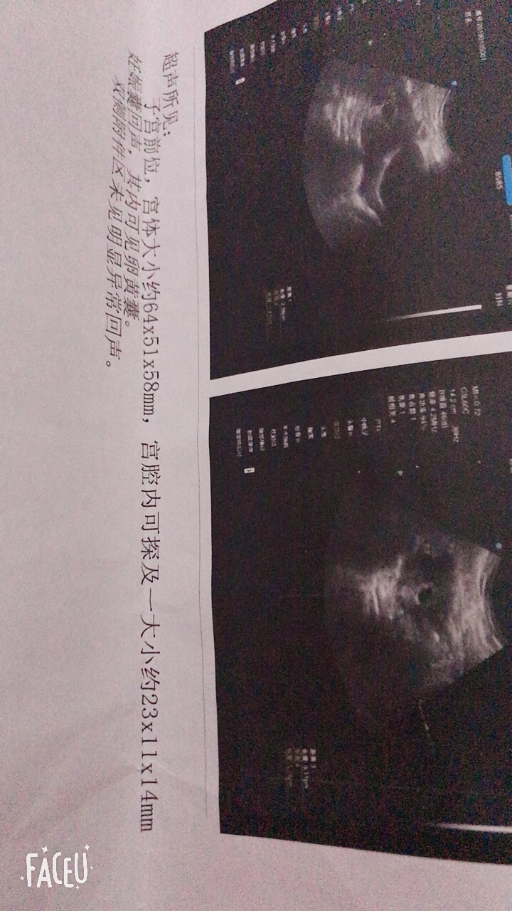 昨天去拍还没长胎芽胎心，医生说过一周再去复查，下面还有褐色分泌物 医生说是有先兆性流产给我开了两盒保胎灵吃，谁知道会不会有事阿，再过一周能不能有胎心胎芽，有同款宝妈嘛