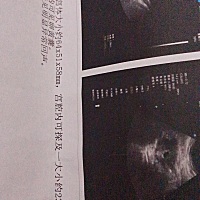 昨天去拍还没长胎芽胎心，医生说过一周再去复查，下面还有褐色分泌物 医生说是有先兆性流产给我开了两盒...