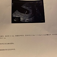 各位宝妈帮忙看看 帮忙看看男宝还是女宝 男女我都喜欢