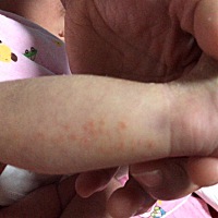 这是肿么了？出生第十四天就这样了呢☹️