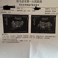 各位大神，帮我看看是男宝还是女宝！一张是五周的，一张是八周的。