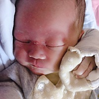 宝宝脸上湿疹特别多，咋办啊😔