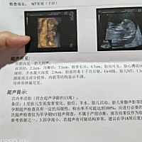 能看得出男孩女孩吗