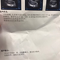 连续两周检查 都是孕囊偏小了 说发育慢了 hcg翻倍不好， 但是又一直有胎心胚芽 不知道怎么办了啊 有没有...