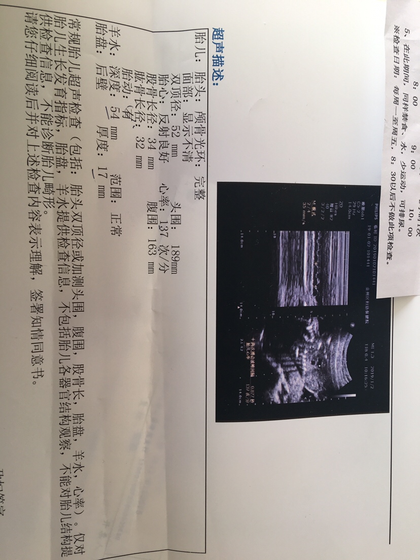 看胎心像男宝，看双顶径和股骨长又像女宝！懵啦，