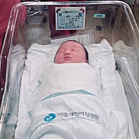 消肿了 更好看了 我的宝贝