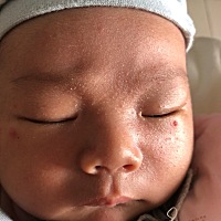 有谁知道宝宝脸上长的是什么吗？还有嘴巴是什么东西？ 你们宝宝纯母乳有喂水吗？