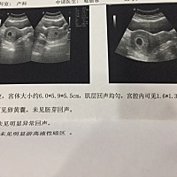 末次11.9，6+1和8+2两次b超图，大家猜猜男宝宝还是女宝宝 这是6 1的 这是8 2的