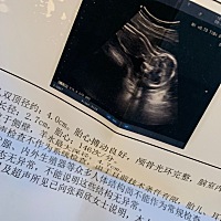 有宝妈妈会看吗？这是男宝还是女宝