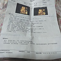 看第一张宝宝图片，是不是再笑啊，如果再笑那就太像她爸爸了，跟她爸爸一样笑起来，哈哈